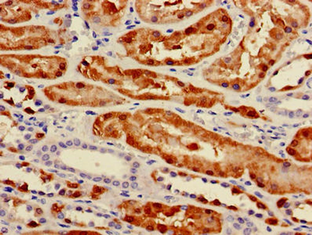 Immunohistochemistry of paraffin-embedded human kidney tissue using CSB-PA017613LA01HU at dilution of 1:100