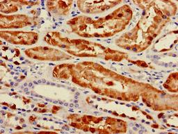 Immunohistochemistry of paraffin-embedded human kidney tissue using CSB-PA017613LA01HU at dilution of 1:100
