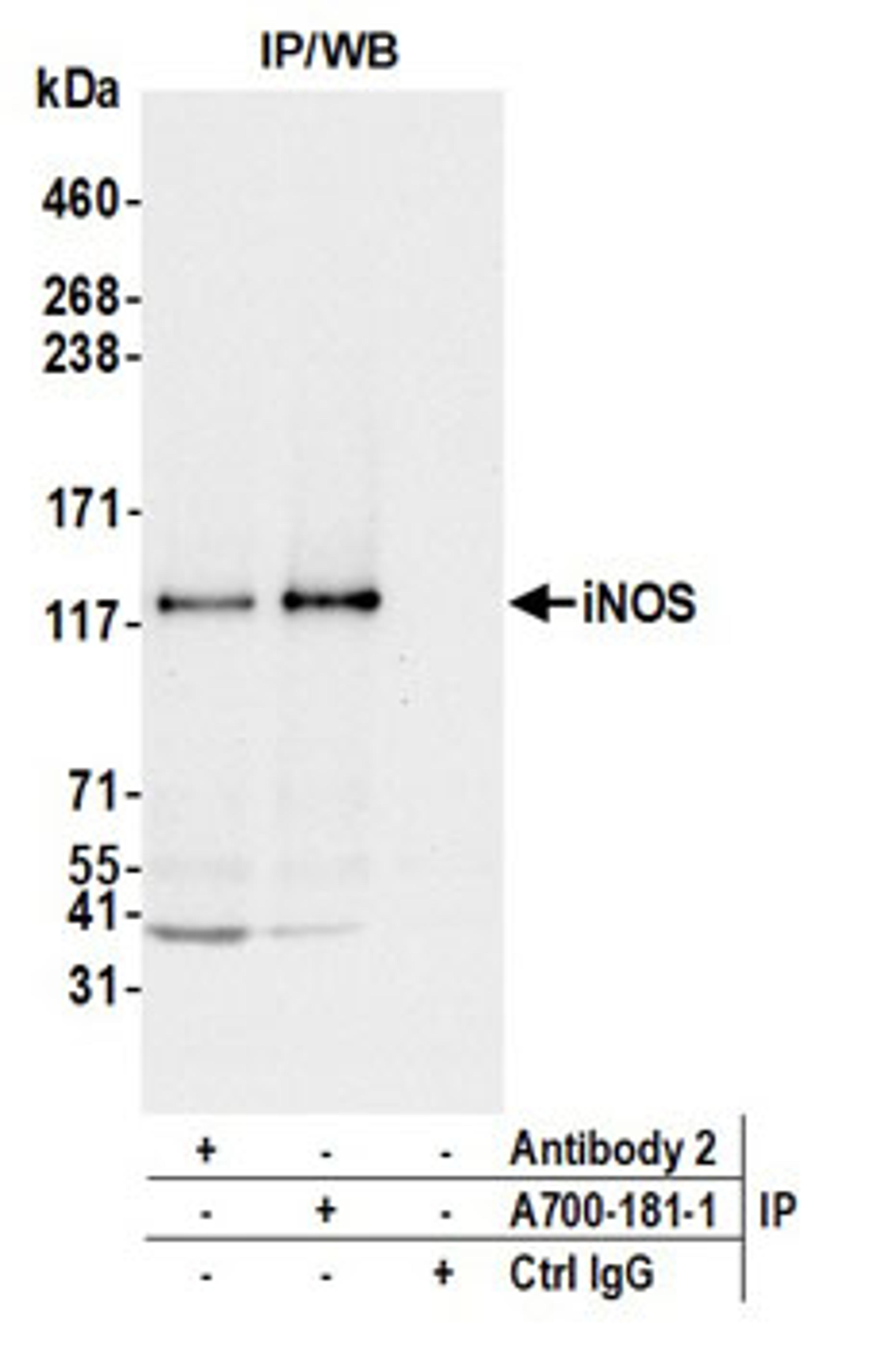 Detection of mouse iNOS by western blot of immunoprecipitates.