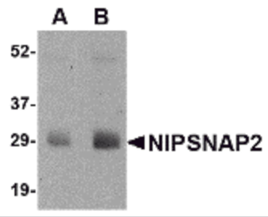 Western blot analysis of NIPSNAP2 in human skeletal muscle tissue lysate with NIPSNAP2 antibody at (A) 0.5 and (B) 1 &#956;g/mL.