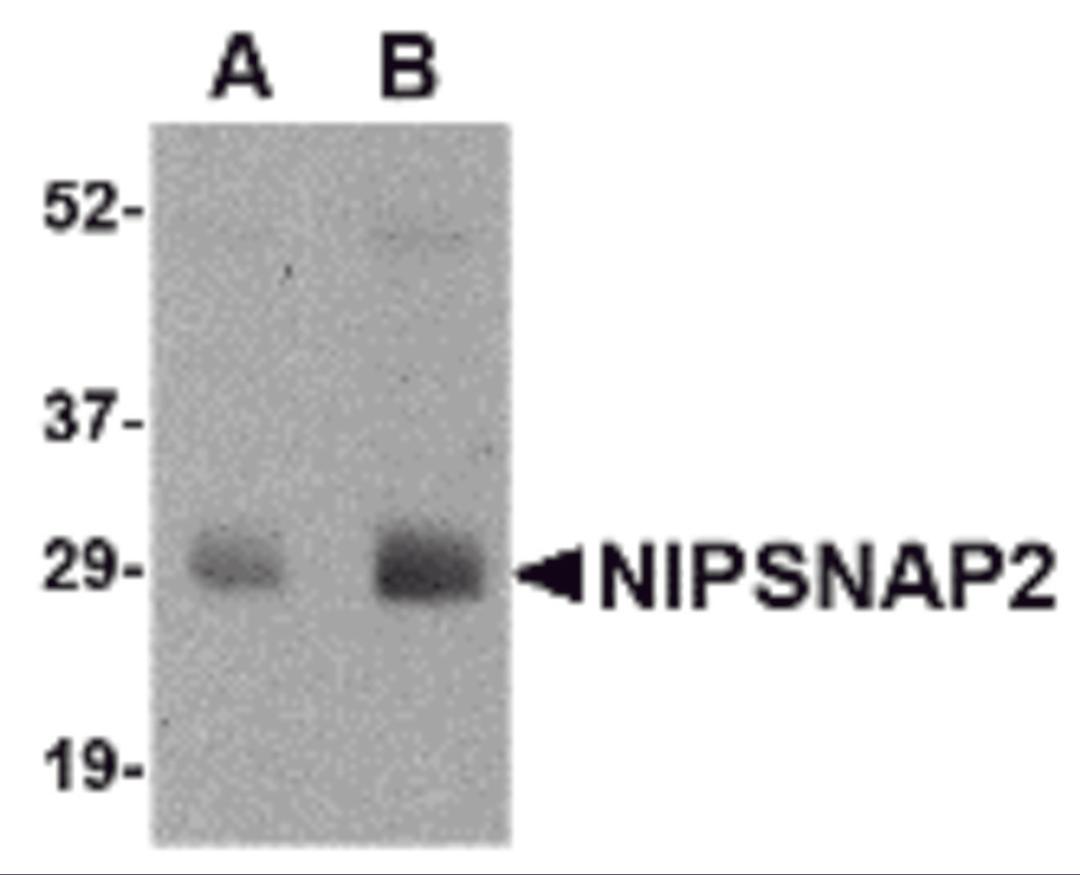 Western blot analysis of NIPSNAP2 in human skeletal muscle tissue lysate with NIPSNAP2 antibody at (A) 0.5 and (B) 1 μg/mL.