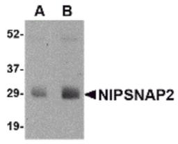 Western blot analysis of NIPSNAP2 in human skeletal muscle tissue lysate with NIPSNAP2 antibody at (A) 0.5 and (B) 1 μg/mL.