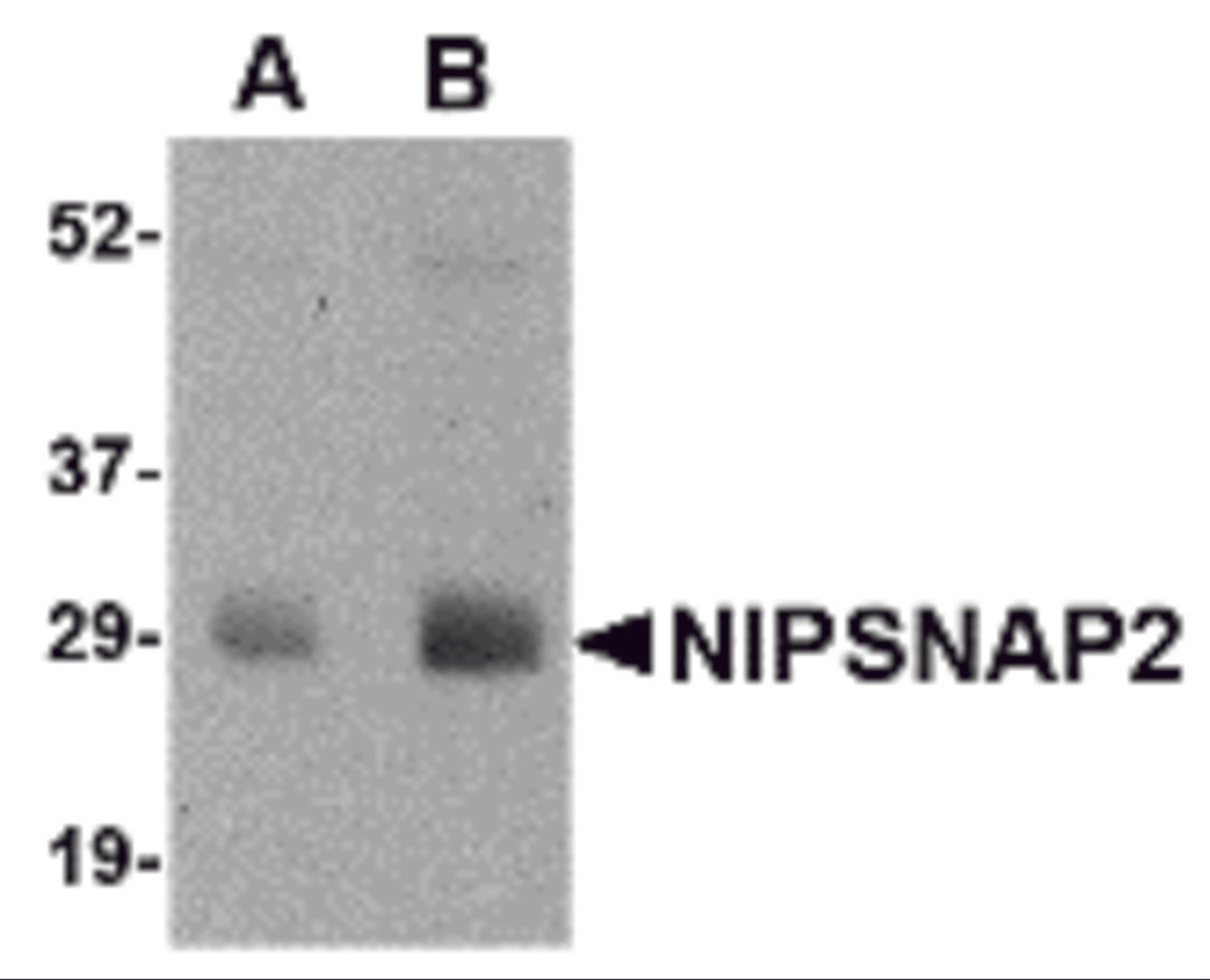 Western blot analysis of NIPSNAP2 in human skeletal muscle tissue lysate with NIPSNAP2 antibody at (A) 0.5 and (B) 1 μg/mL.