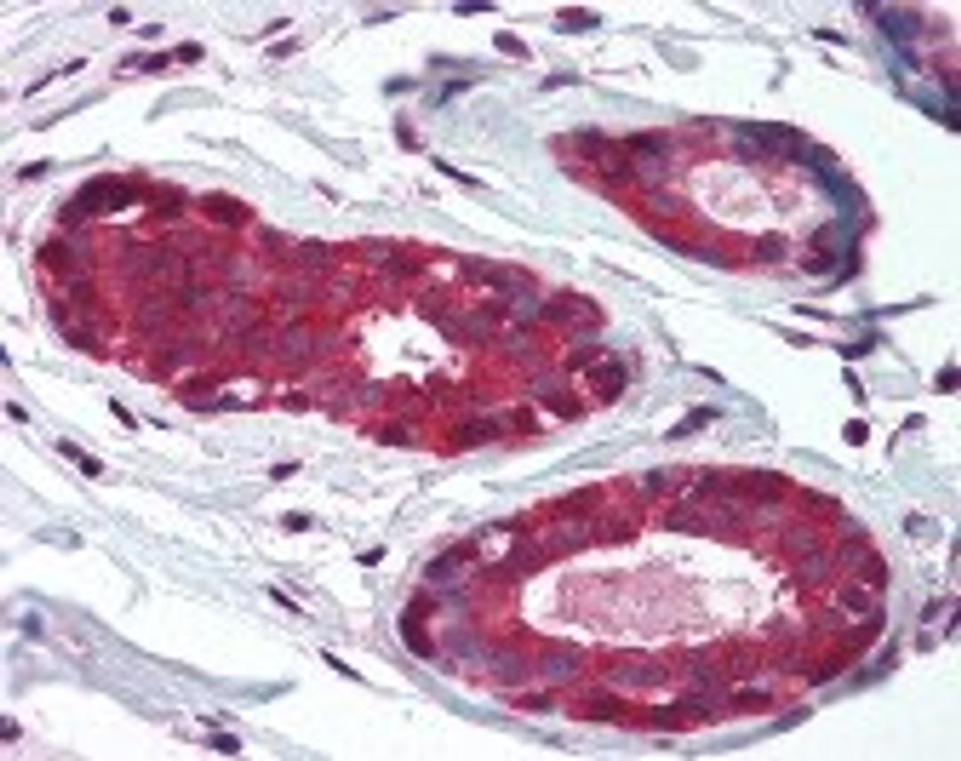 Immunohistochemistry staining of NEDD4 in breast: formlin-fixed paraffin-embedded (ffpe)NEDD4 Antibody.