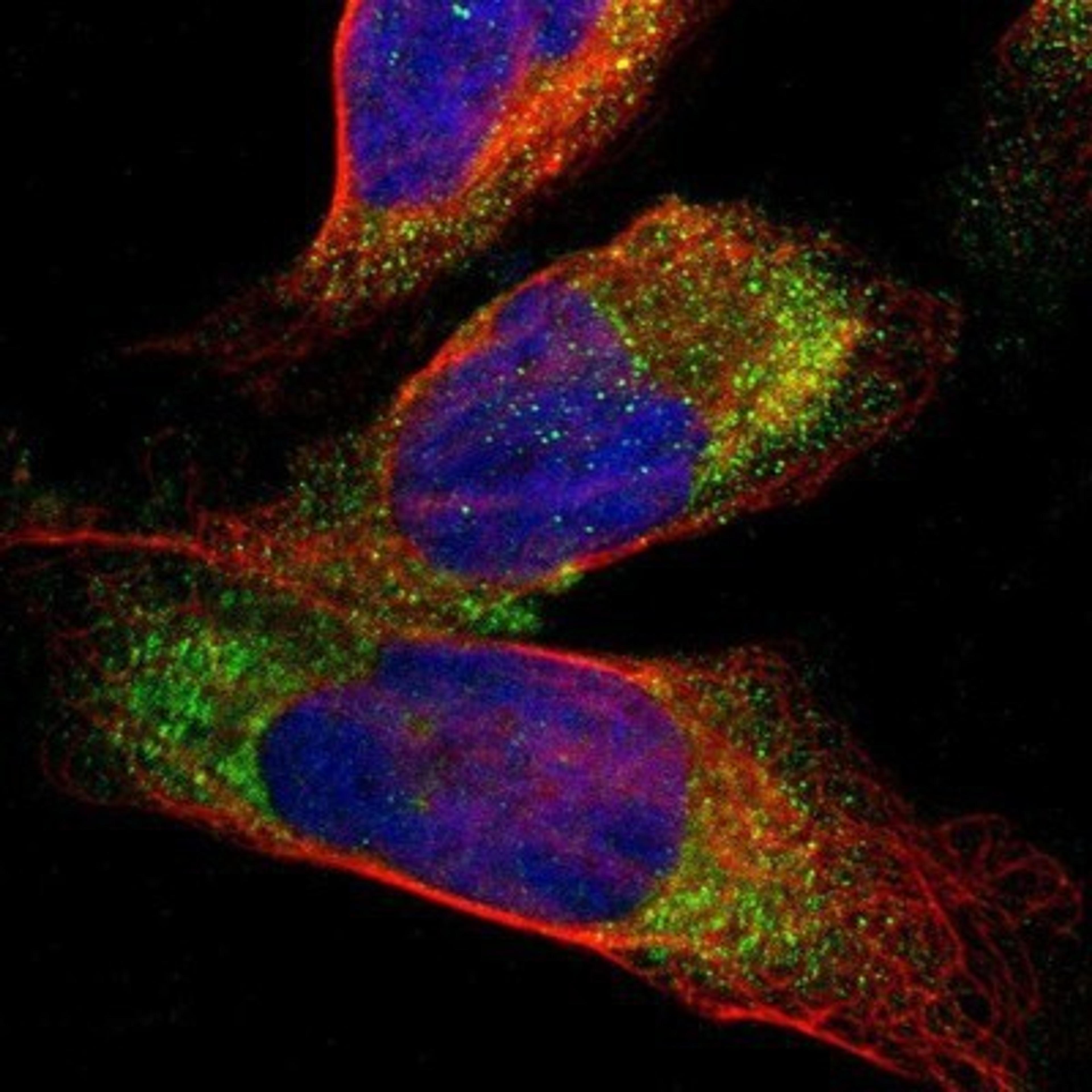 Immunocytochemistry/Immunofluorescence: Cathepsin S Antibody [NBP1-85807] - Staining of human cell line U-2 OS shows positivity in vesicles.