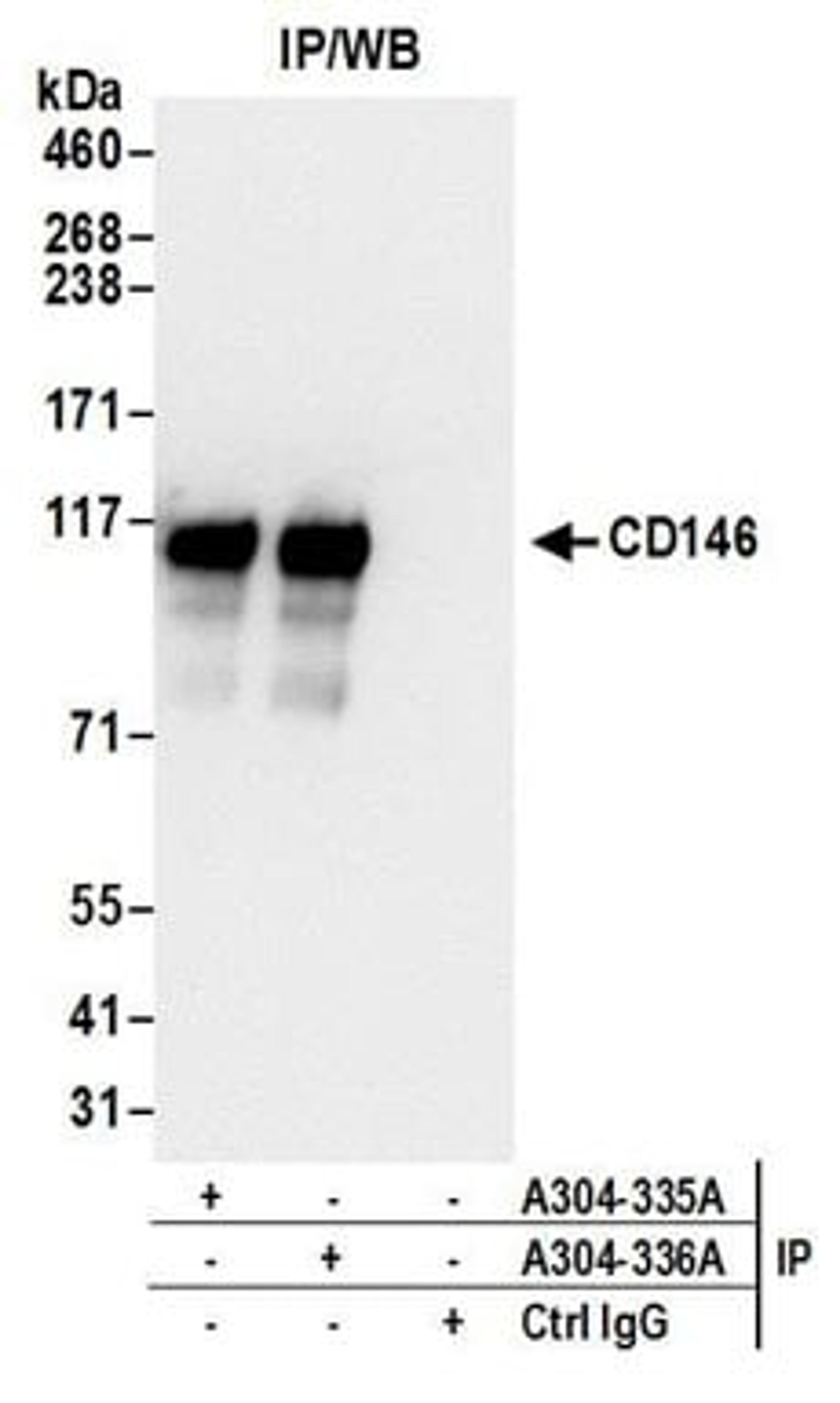 Detection of human CD146 by western blot of immunoprecipitates.