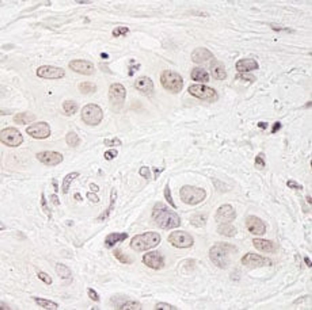 Detection of human BCAS3 by immunohistochemistry.