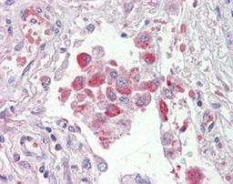 orb18609 (2.5ug/ml) staining of paraffin embedded Human Lung. Steamed antigen retrieval with citrate buffer pH 6, AP-staining.