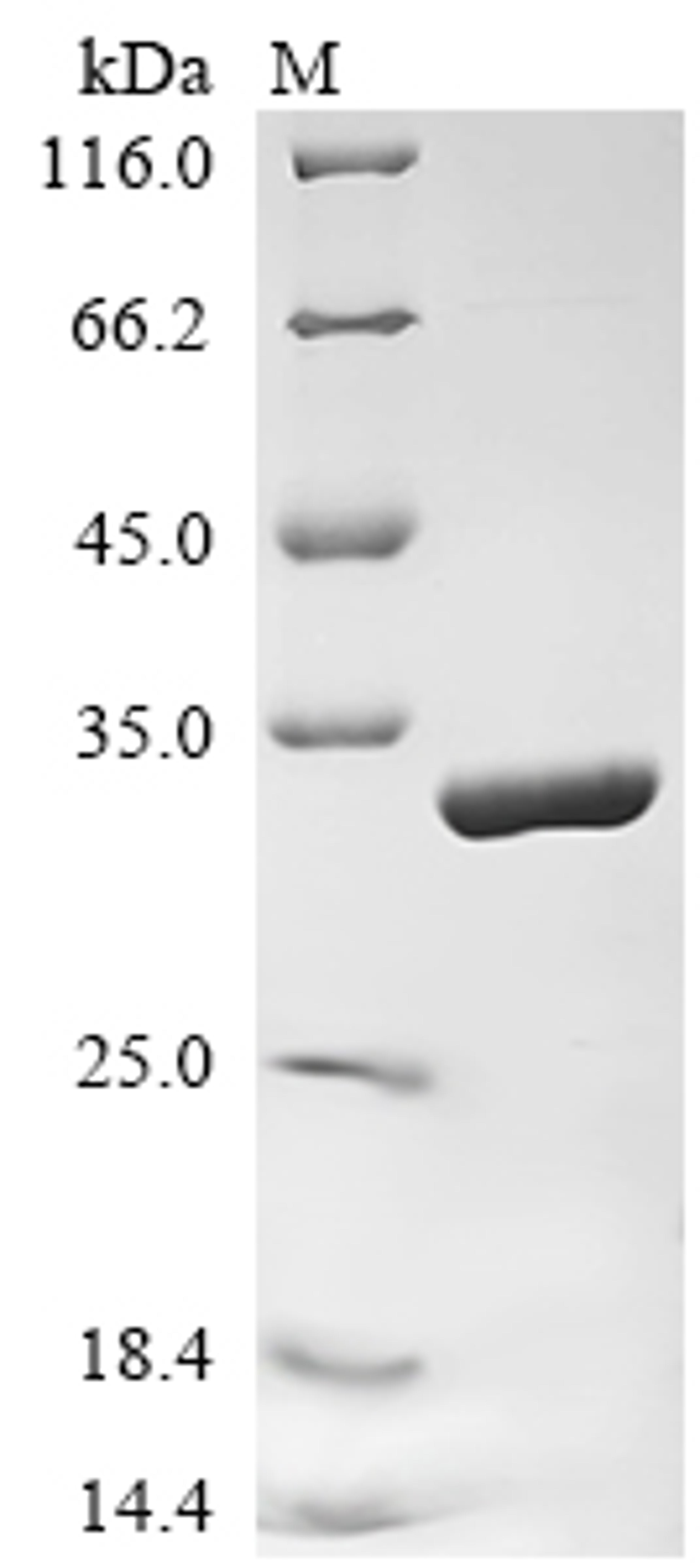 (Tris-Glycine gel) Discontinuous SDS-PAGE (reduced) with 5% enrichment gel and 15% separation gel.