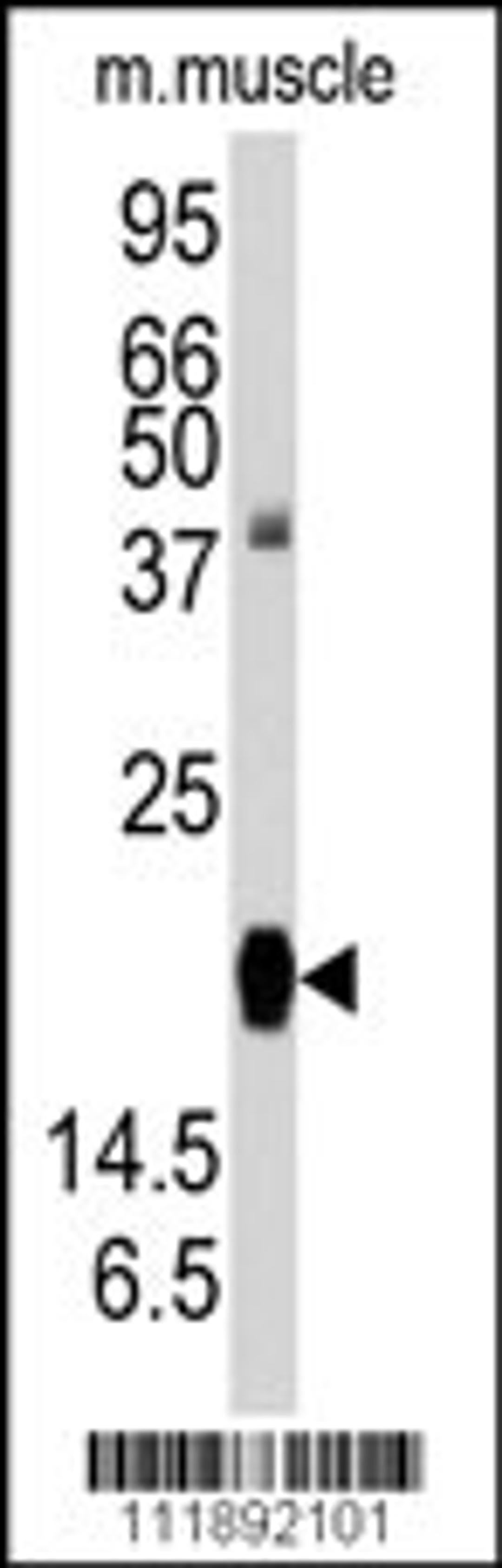 Western blot analysis of anti-RGS19 Antibody (S151) in mouse muscle tissue lysates (35ug/lane).