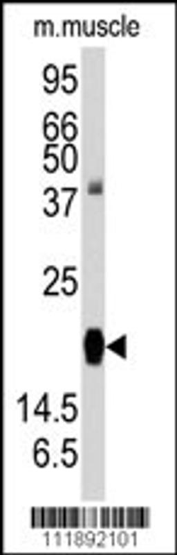 Western blot analysis of anti-RGS19 Antibody (S151) in mouse muscle tissue lysates (35ug/lane).