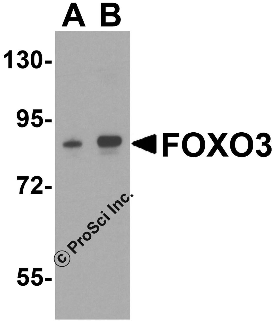 Western blot analysis of FOXO3 in A-20 cell lysate with FOXO3 antibody at (A) 0.5 and (B) 1 &#956;g/mL.