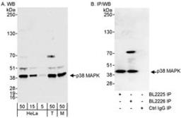 Detection of human and mouse p38 MAPK by western blot (h&m) and immunoprecipitation (h).