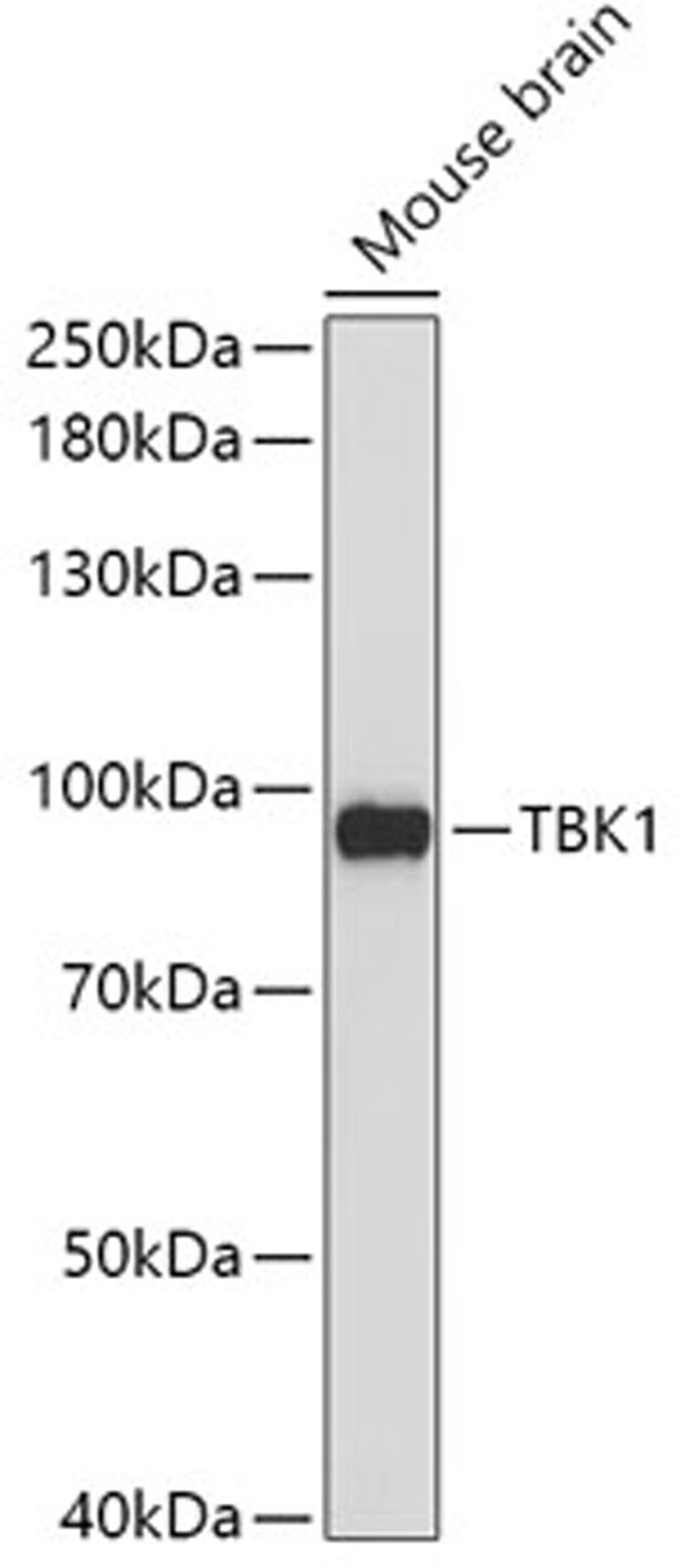 Western blot - TBK1 antibody (A2573)