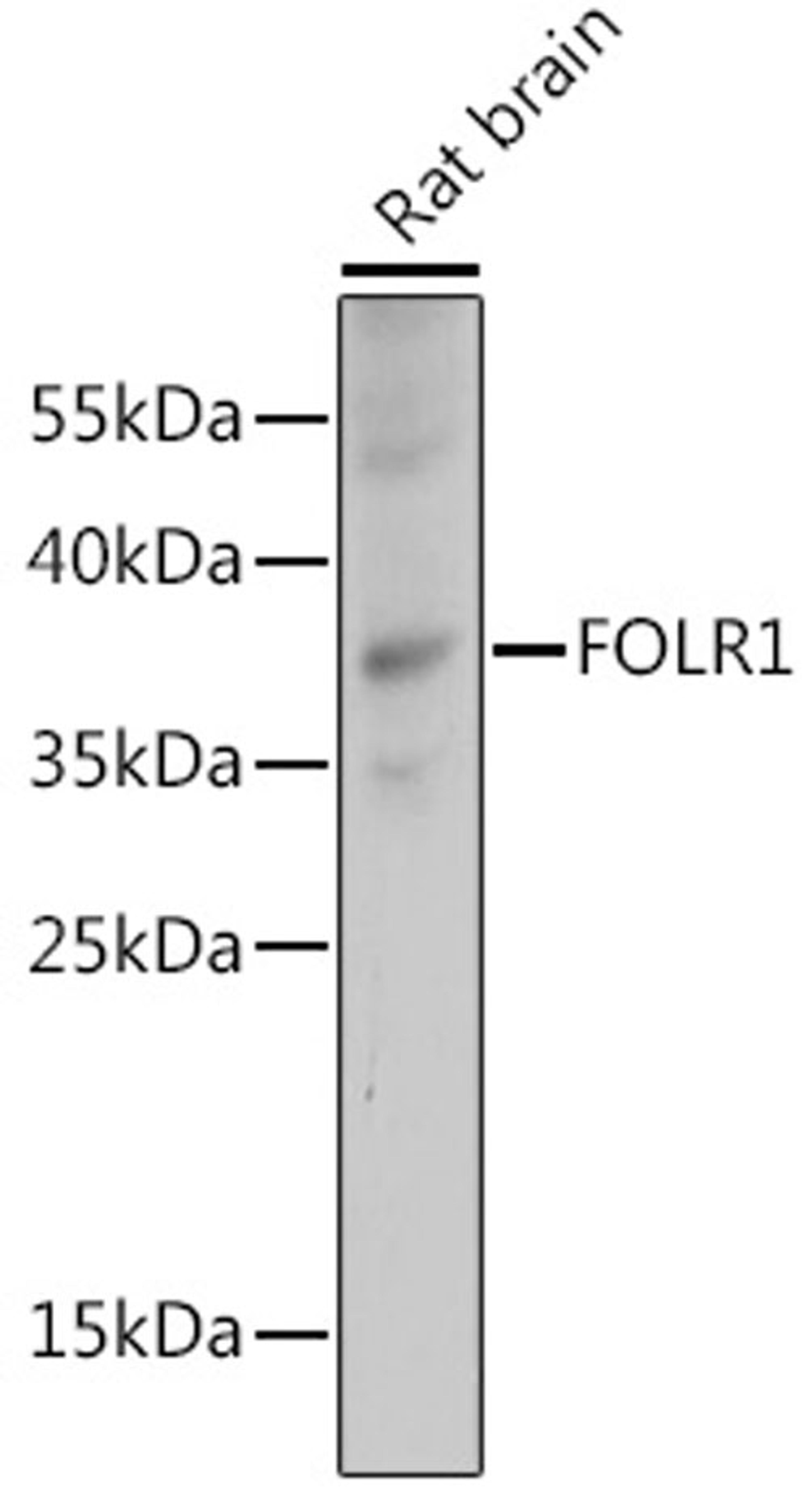 Western blot - FOLR1 antibody (A15672)