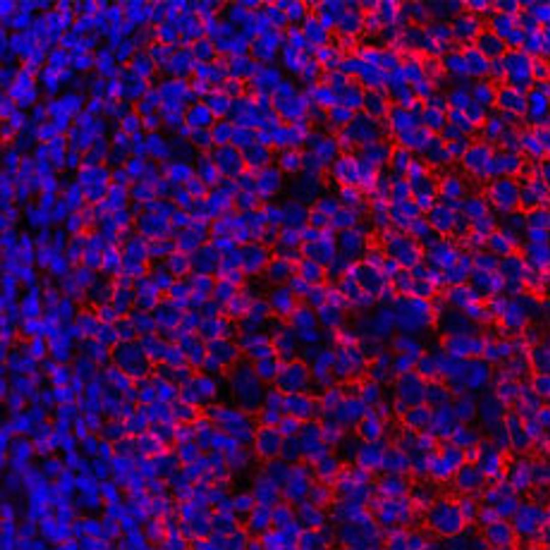 Detection of human CD20 by immunhistochemistry.