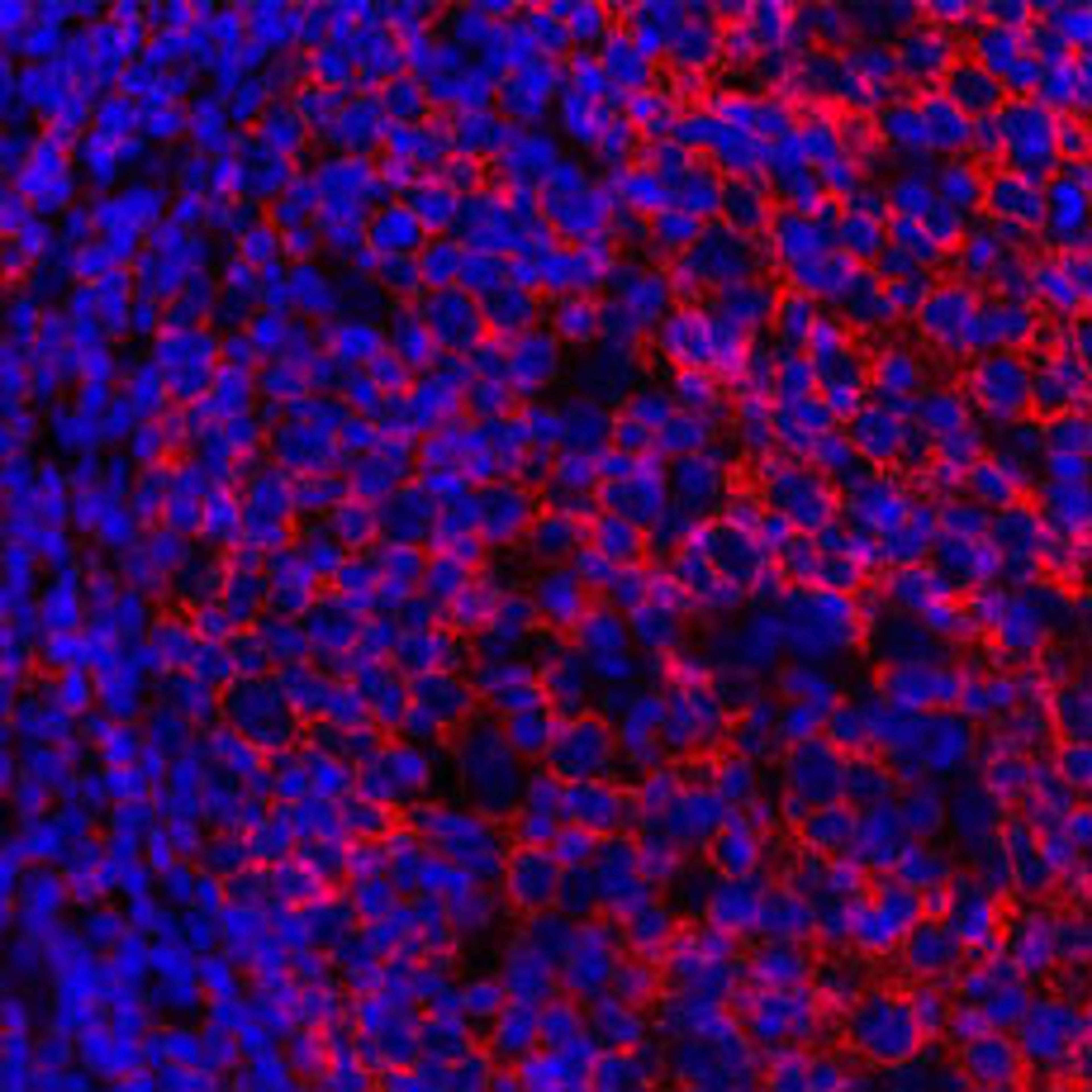 Detection of human CD20 by immunhistochemistry.