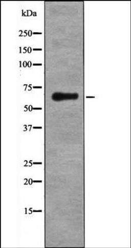 Western blot analysis of Forskolin treated HeLa whole cell lysates using LKB1 -Phospho-Ser334- antibody