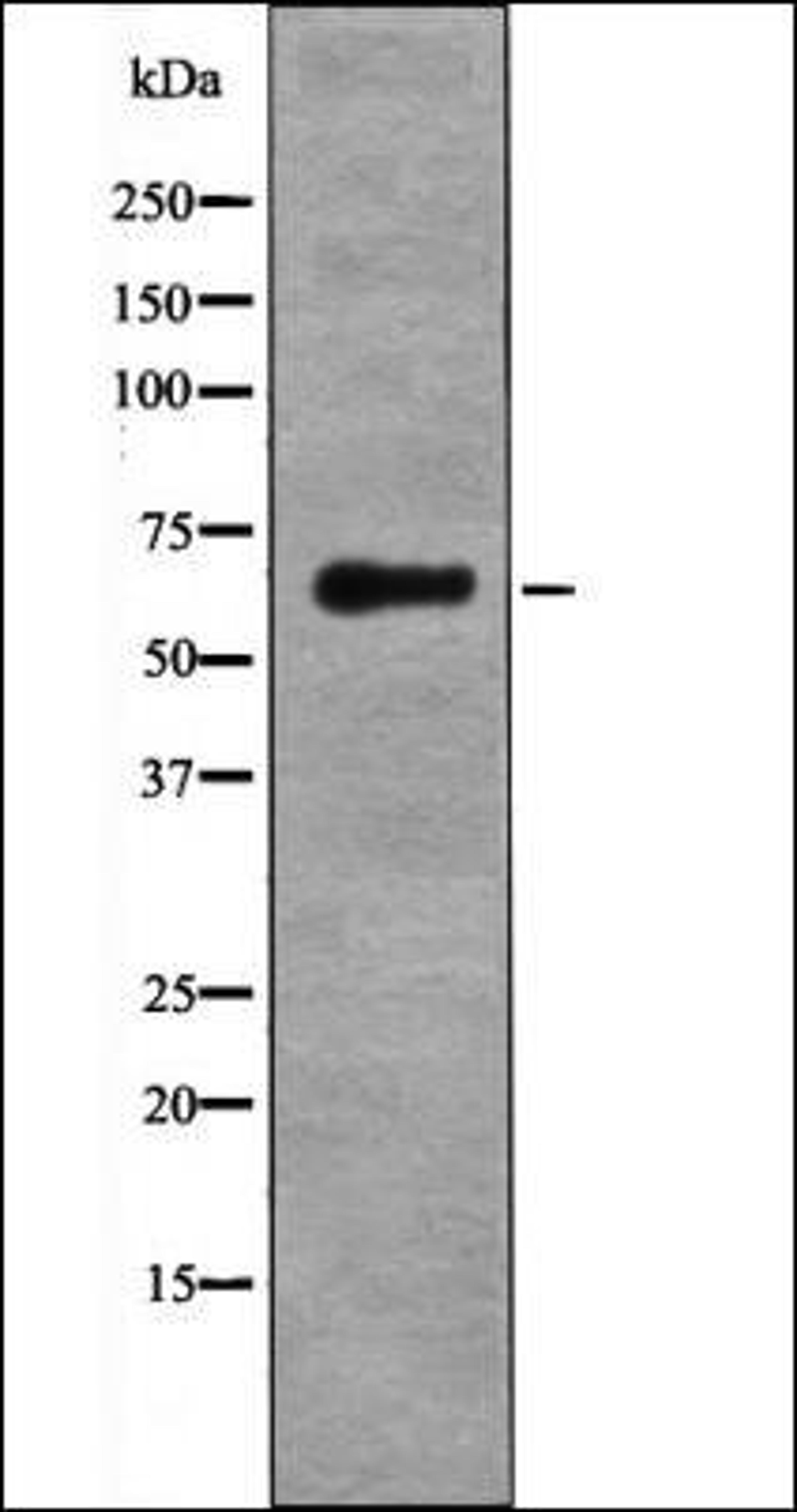 Western blot analysis of Forskolin treated HeLa whole cell lysates using LKB1 -Phospho-Ser334- antibody