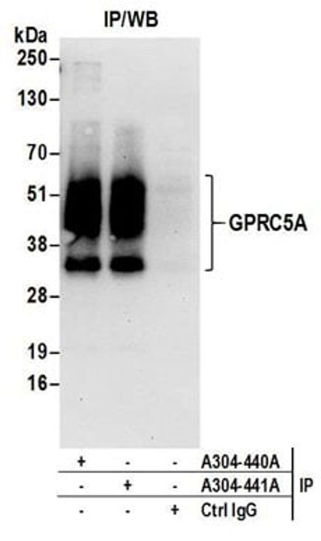 Detection of human GPRC5A by western blot of immunoprecipitates.