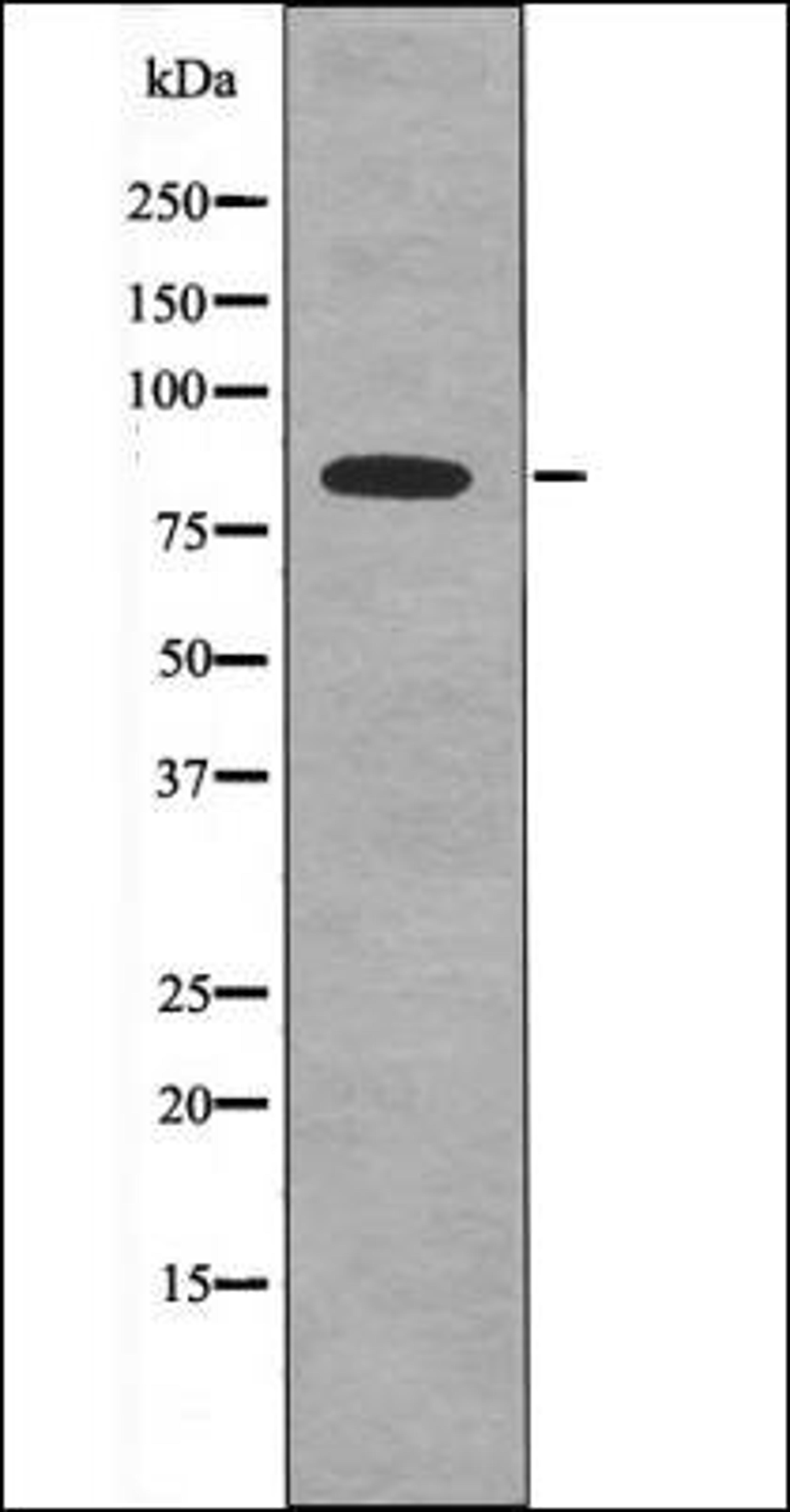 Western blot analysis of EGF treated HeLa whole cell lysates using SIK -Phospho-Thr182- antibody