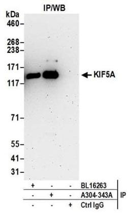 Detection of human KIF5A by western blot of immunoprecipitates.