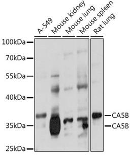 Western blot - CA5B antibody (A17633)