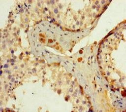 Immunohistochemistry of paraffin-embedded human testis tissue using CSB-PA007769LA01HU at dilution of 1:100