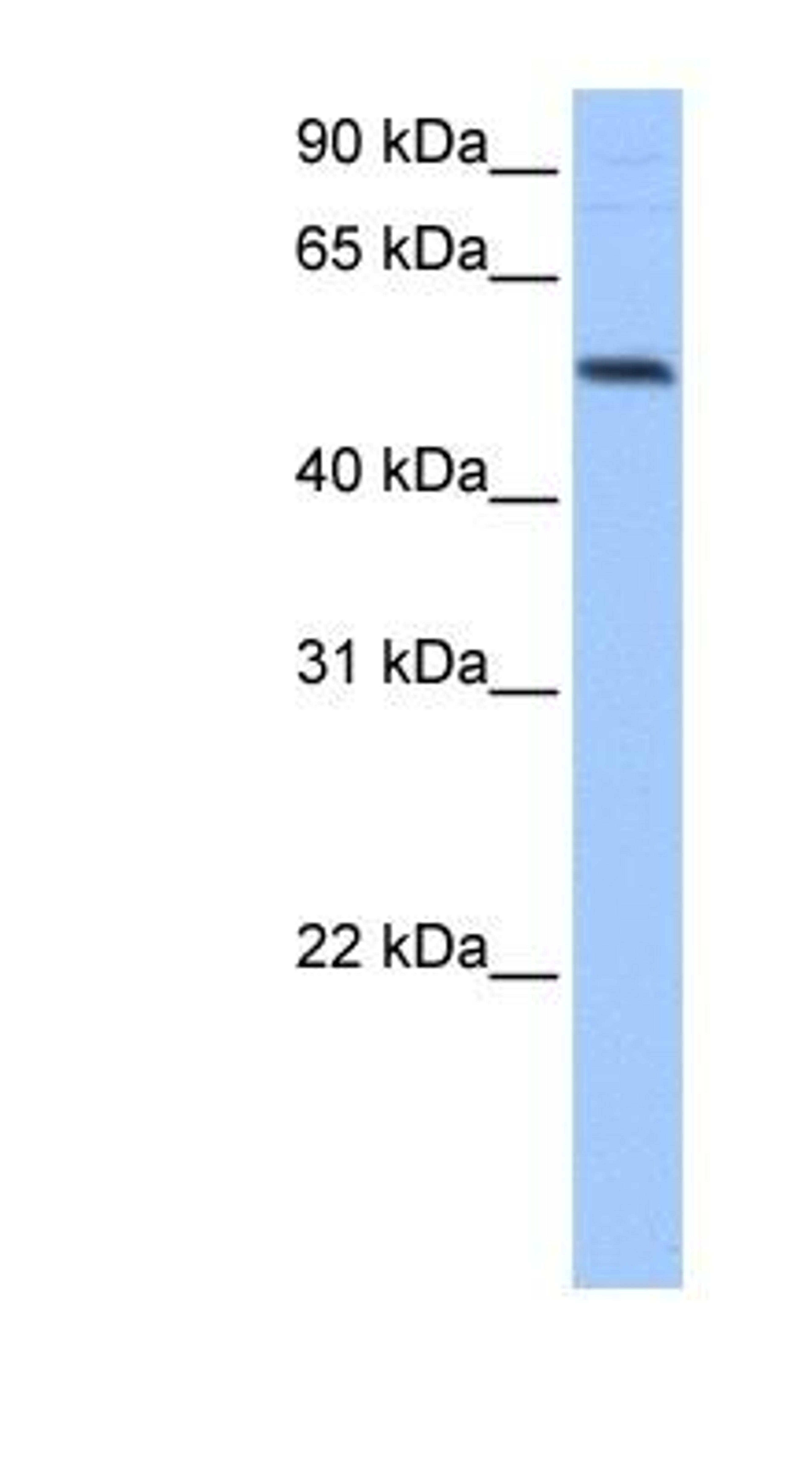 Western Blot: GRSF1 Antibody [NBP1-57316] - Hela cell lysate, concentration 0.2-1 ug/ml.