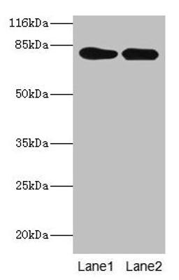 Western blot. All lanes: LHCGR antibody at 2µg/ml. Lane 1: Mouse brain tissue. Lane 2: Mouse kidney tissue. Secondary. Goat polyclonal to rabbit IgG at 1/10000 dilution. Predicted band size: 79, 72 kDa. Observed band size: 79 kDa