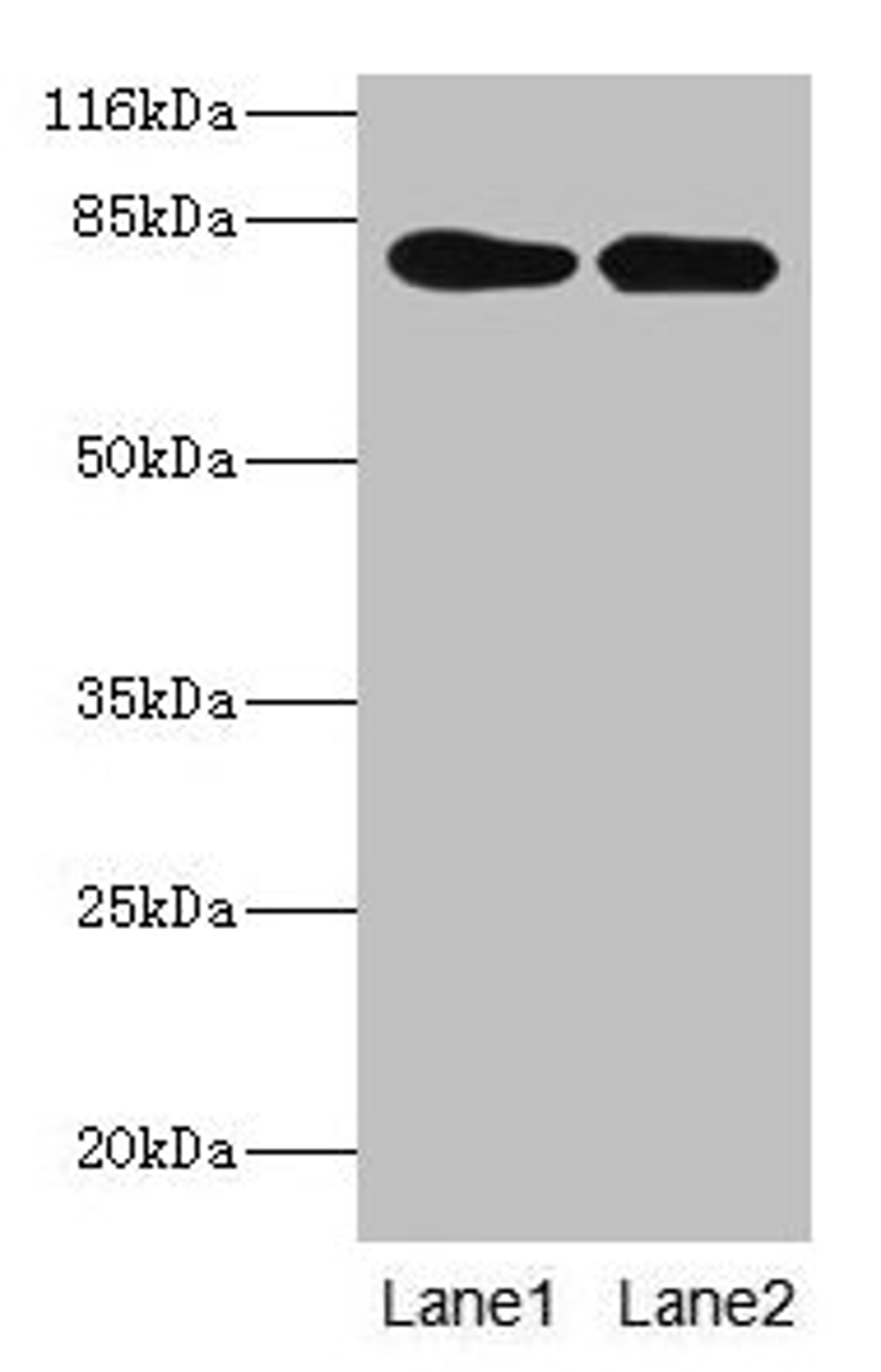 Western blot. All lanes: LHCGR antibody at 2µg/ml. Lane 1: Mouse brain tissue. Lane 2: Mouse kidney tissue. Secondary. Goat polyclonal to rabbit IgG at 1/10000 dilution. Predicted band size: 79, 72 kDa. Observed band size: 79 kDa