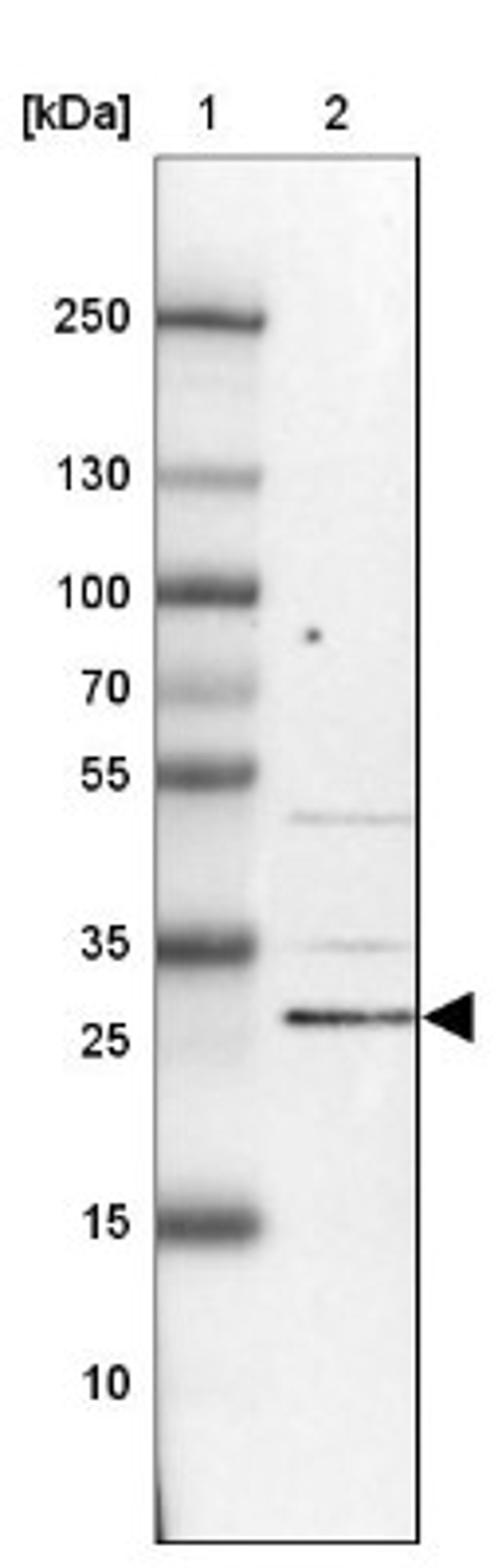 Western Blot: KIAA1257 Antibody [NBP2-14154] - Lane 1: Marker [kDa] 250, 130, 100, 70, 55, 35, 25, 15, 10<br/>Lane 2: Liver