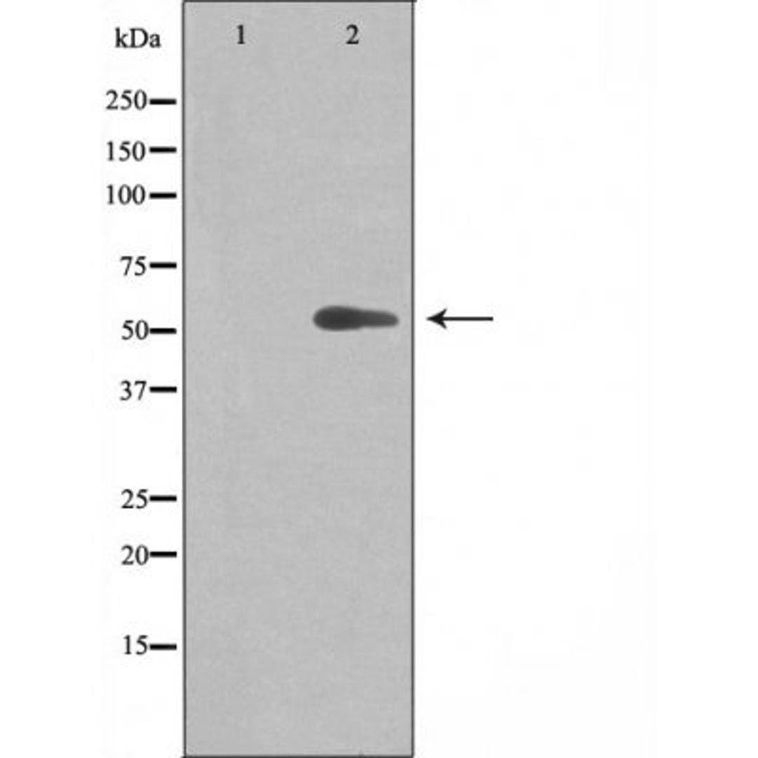 Western blot analysis of Jurkat cells using 20A1 (Cytochrome P450) antibody