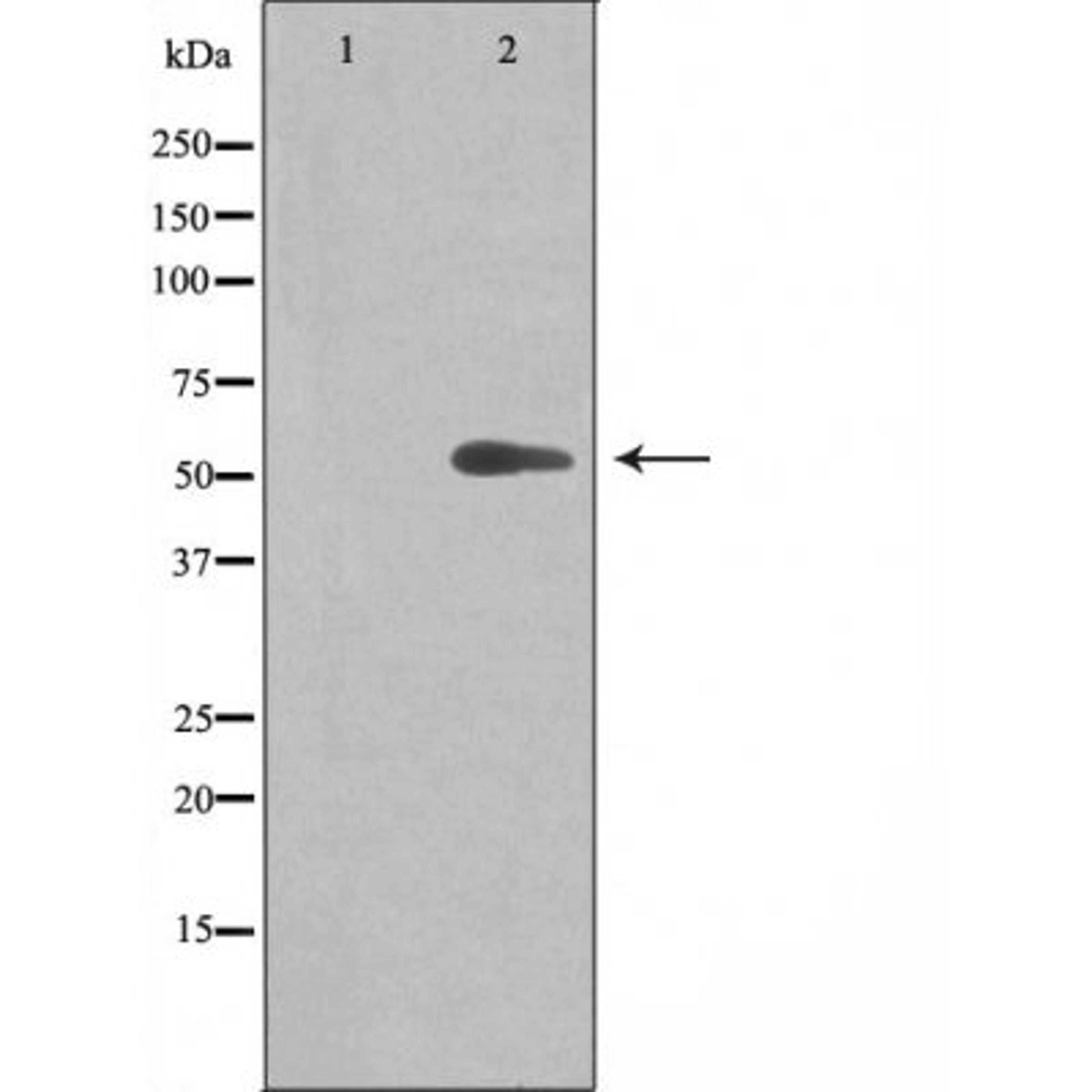 Western blot analysis of Jurkat cells using 20A1 (Cytochrome P450) antibody