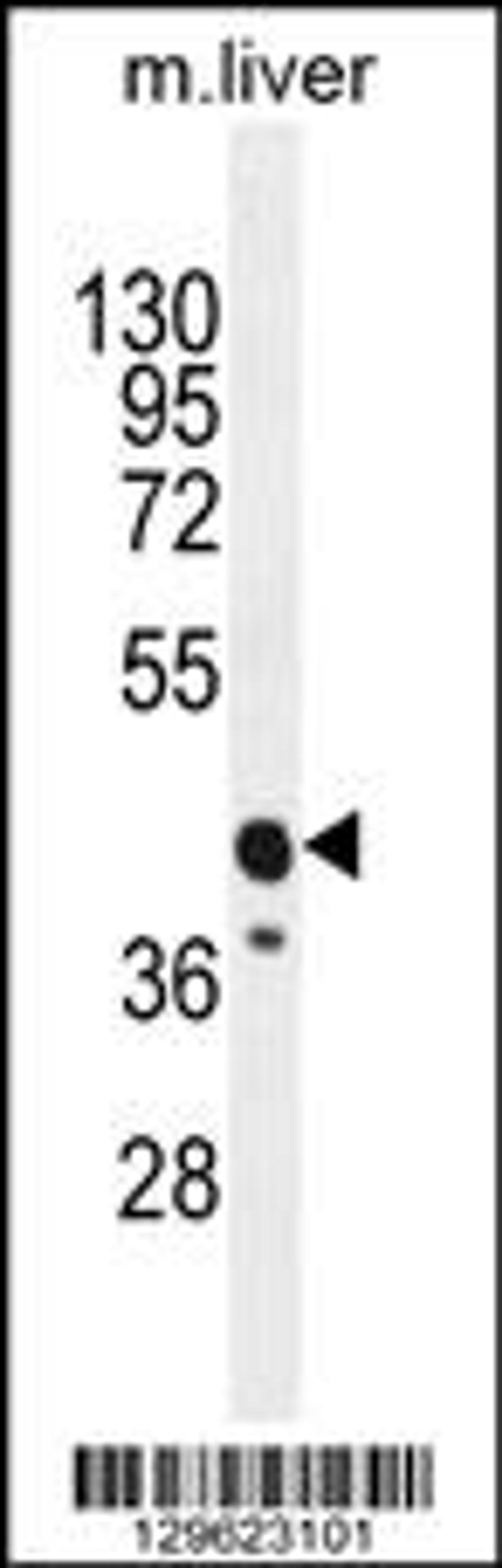 Western blot analysis in mouse liver tissue lysates (35ug/lane).