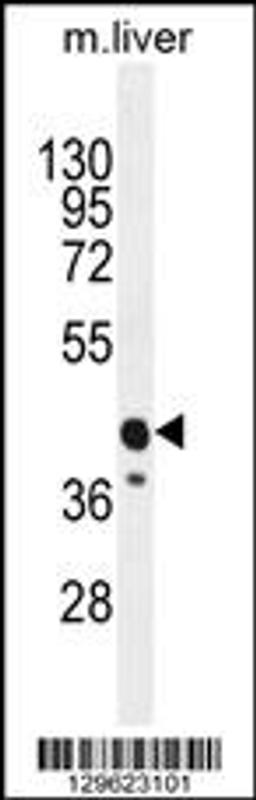 Western blot analysis in mouse liver tissue lysates (35ug/lane).