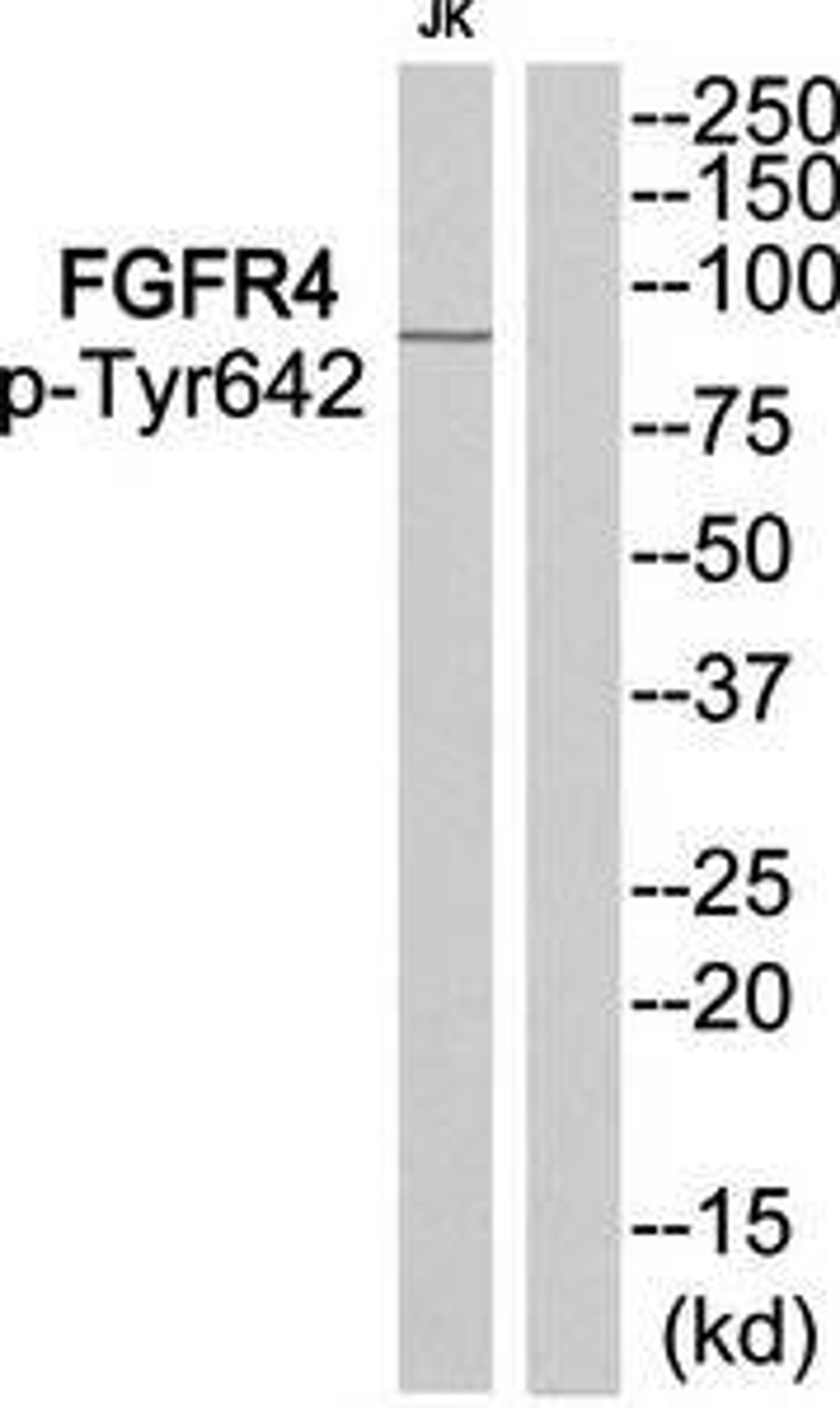 Western blot analysis of extracts from JurKat cells using FGFR4 (phospho-Tyr642) antibody