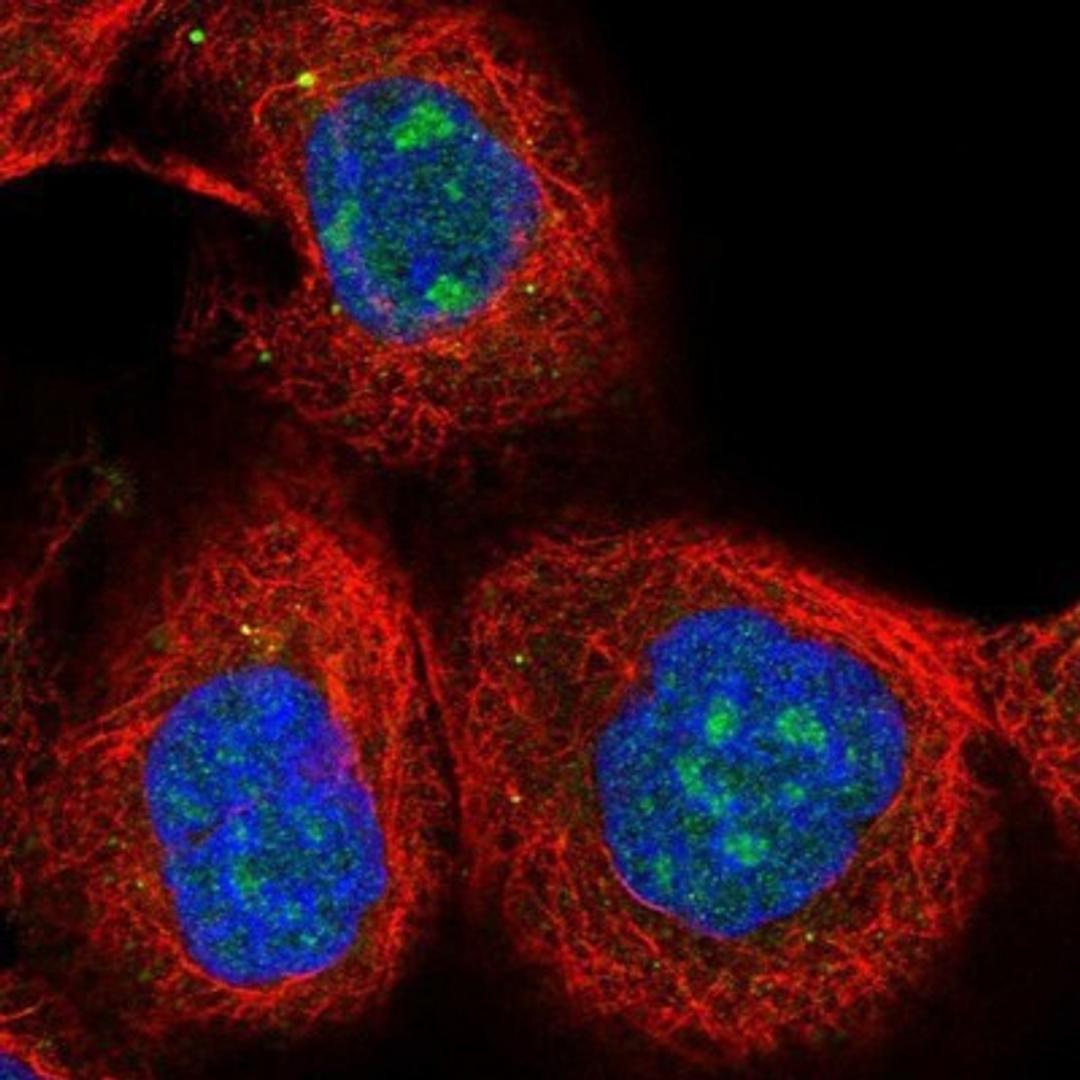 Immunocytochemistry/Immunofluorescence: PINX1 Antibody [NBP1-83643] - Staining of human cell line A-431 shows positivity in nucleus, nucleoli & vesicles.