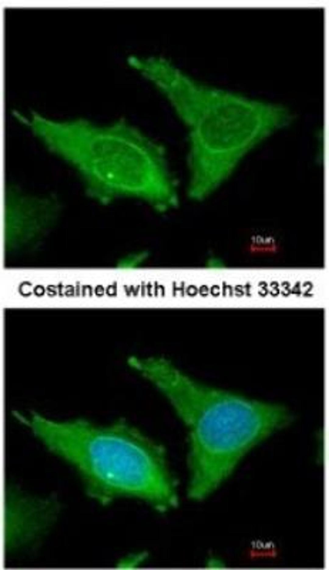 Immunocytochemistry/Immunofluorescence: Fibrinogen Antibody [NBP1-33582] - Analysis of methanol-fixed HeLa, using antibody at 1:200 dilution.