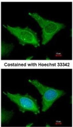 Immunocytochemistry/Immunofluorescence: Fibrinogen Antibody [NBP1-33582] - Analysis of methanol-fixed HeLa, using antibody at 1:200 dilution.