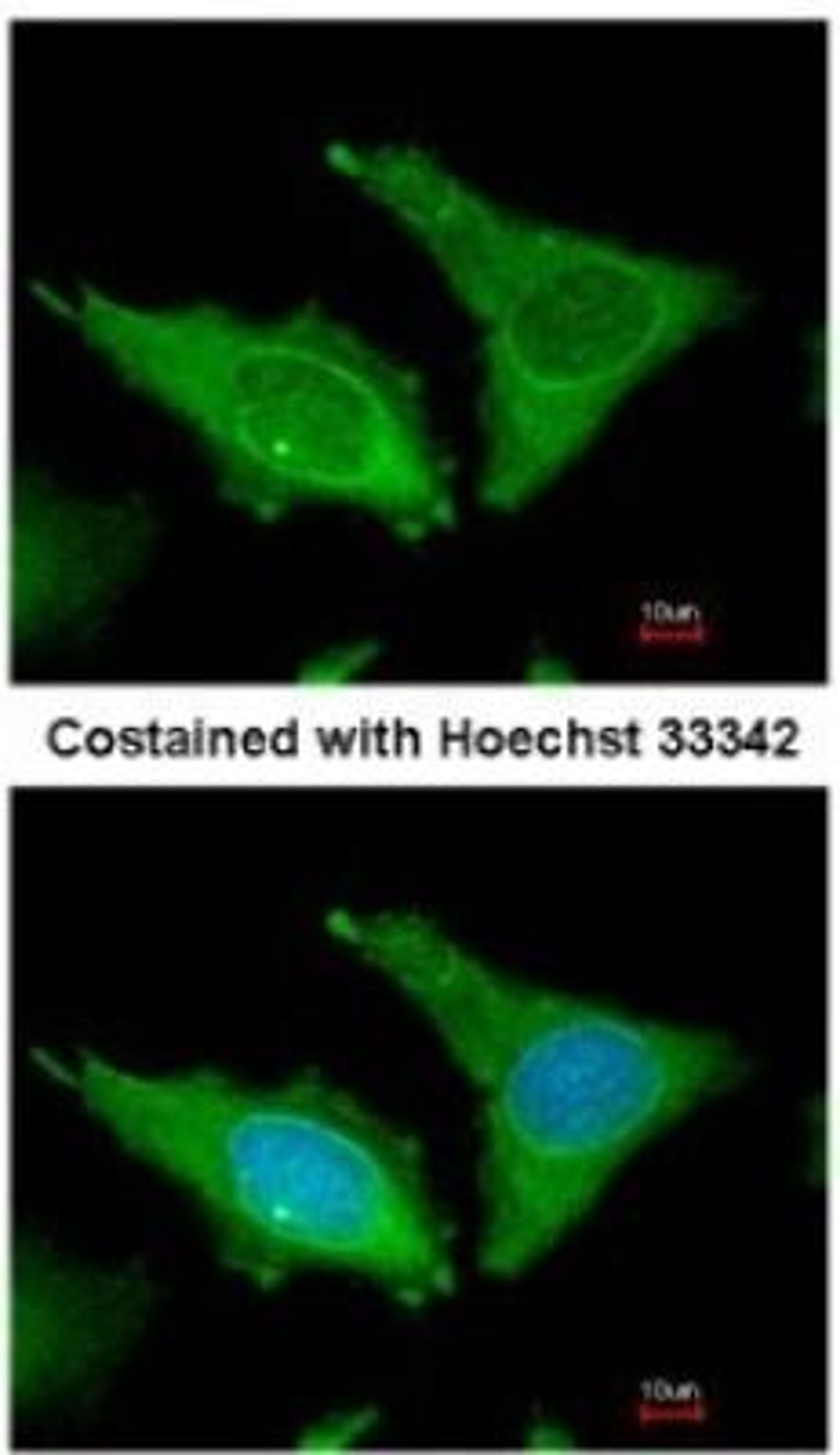 Immunocytochemistry/Immunofluorescence: Fibrinogen Antibody [NBP1-33582] - Analysis of methanol-fixed HeLa, using antibody at 1:200 dilution.