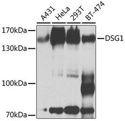 Western blot - DSG1 antibody (A9812)