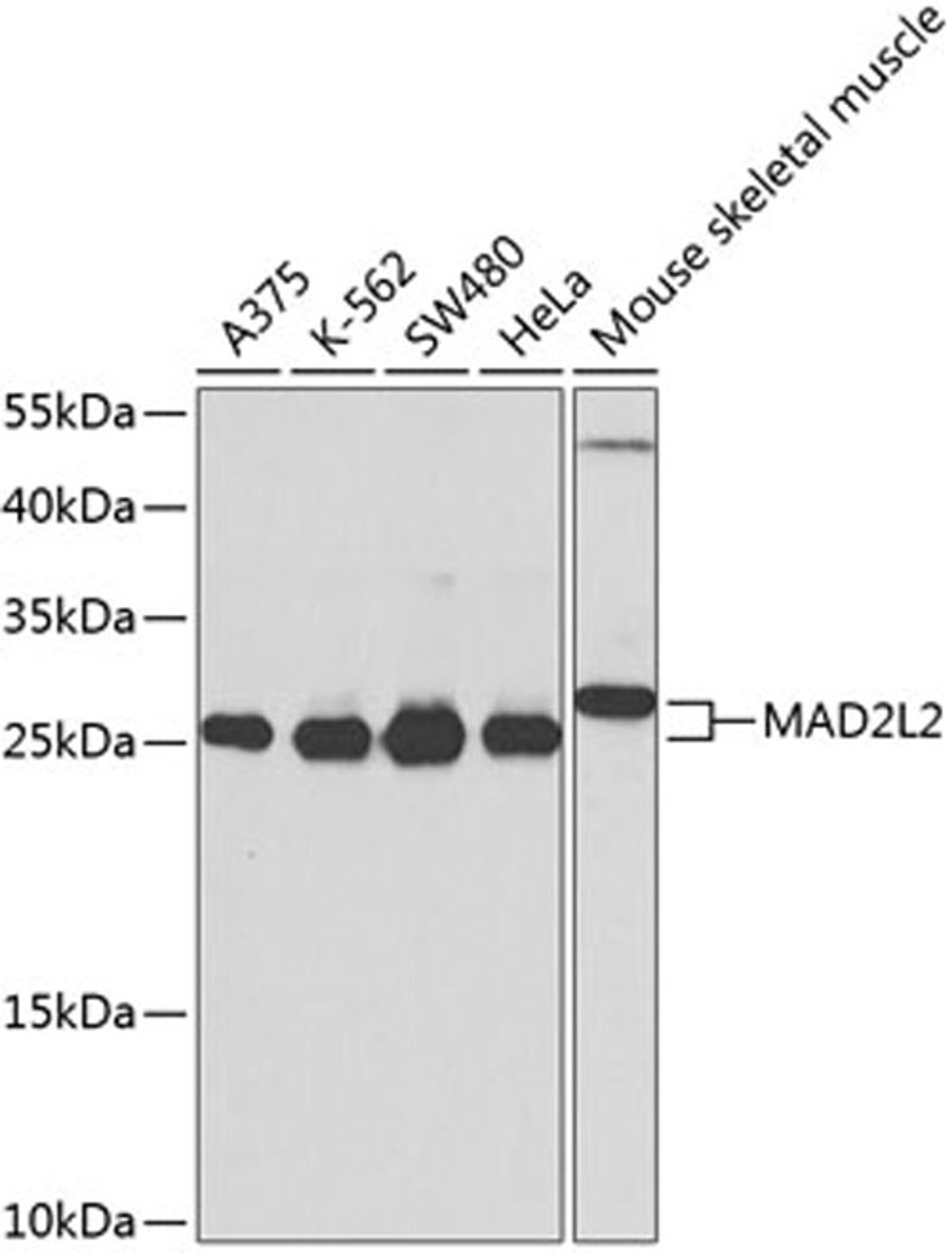 Western blot - MAD2L2 antibody (A9861)