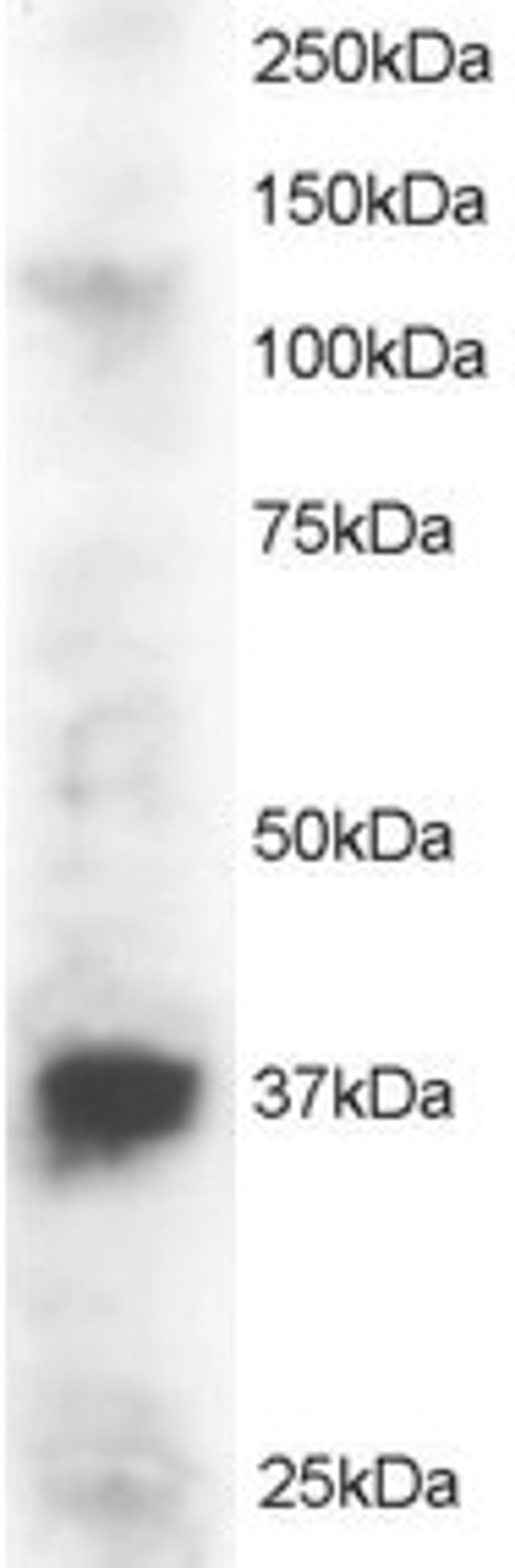 46-191 staining (2ug/ml) of Jurkat lysate (RIPA buffer, 30ug total protein per lane). Primary incubated for 1 hour. Detected by western blot using chemiluminescence.