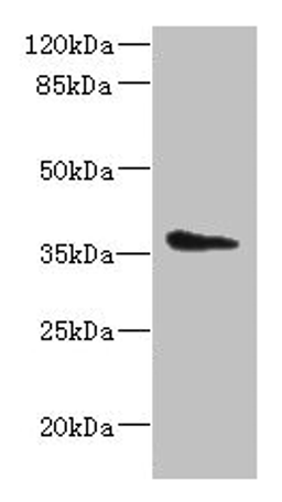 Western blot. All lanes: AASDHPPT antibody at 2µg/ml + HepG2 whole cell lysate. Secondary. Goat polyclonal to rabbit IgG at 1/10000 dilution. Predicted band size: 36, 16 kDa. Observed band size: 36 kDa