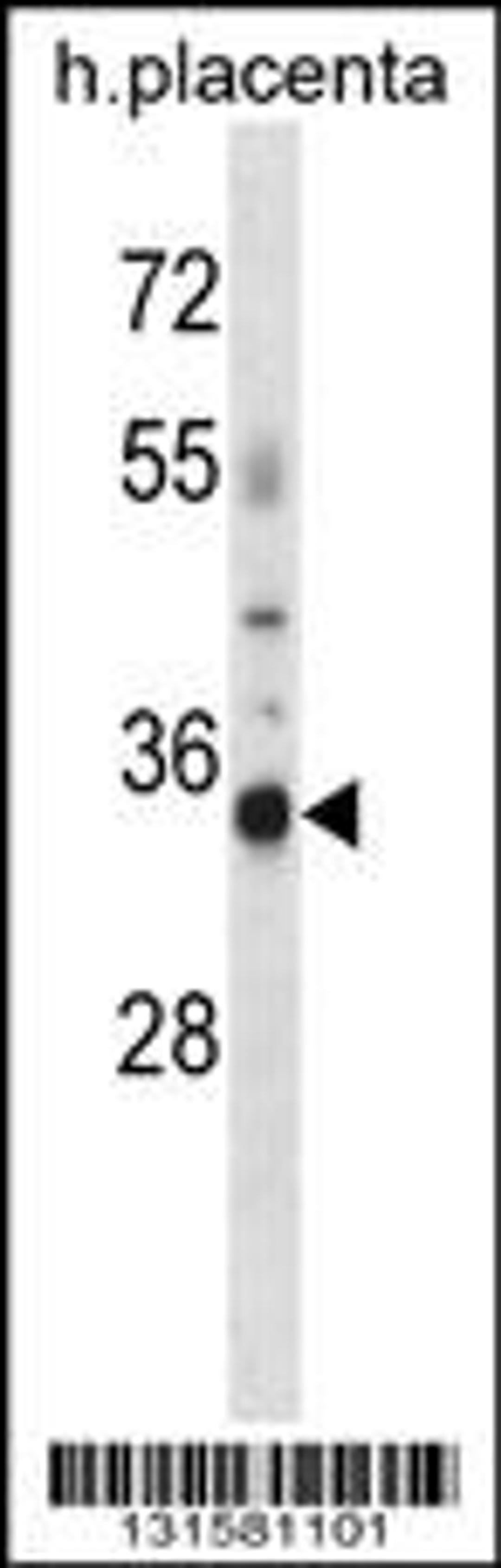 Western blot analysis in human placenta tissue lysates (35ug/lane).