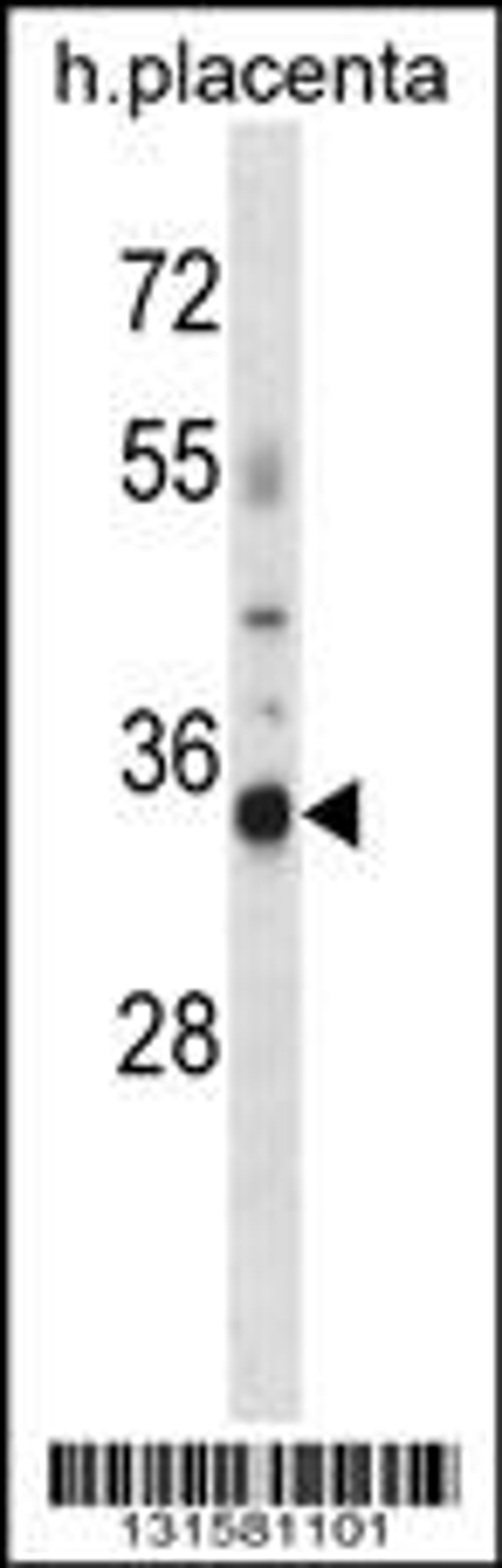 Western blot analysis in human placenta tissue lysates (35ug/lane).