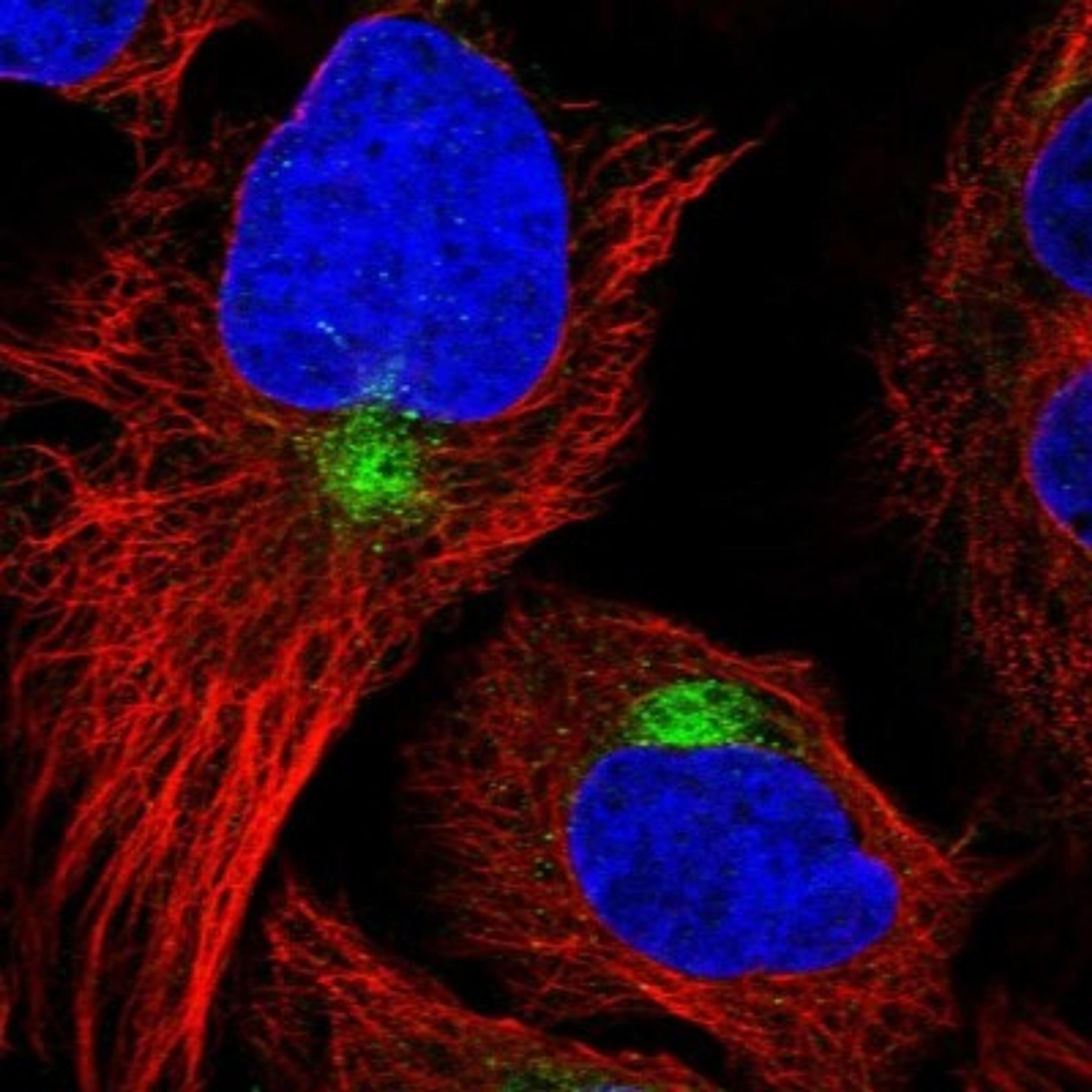 Immunocytochemistry/Immunofluorescence: KLHDC8A Antibody [NBP1-84604] - Staining of human cell line U-2 OS shows positivity in cytoskeleton (intermediate filaments) & aggresome.