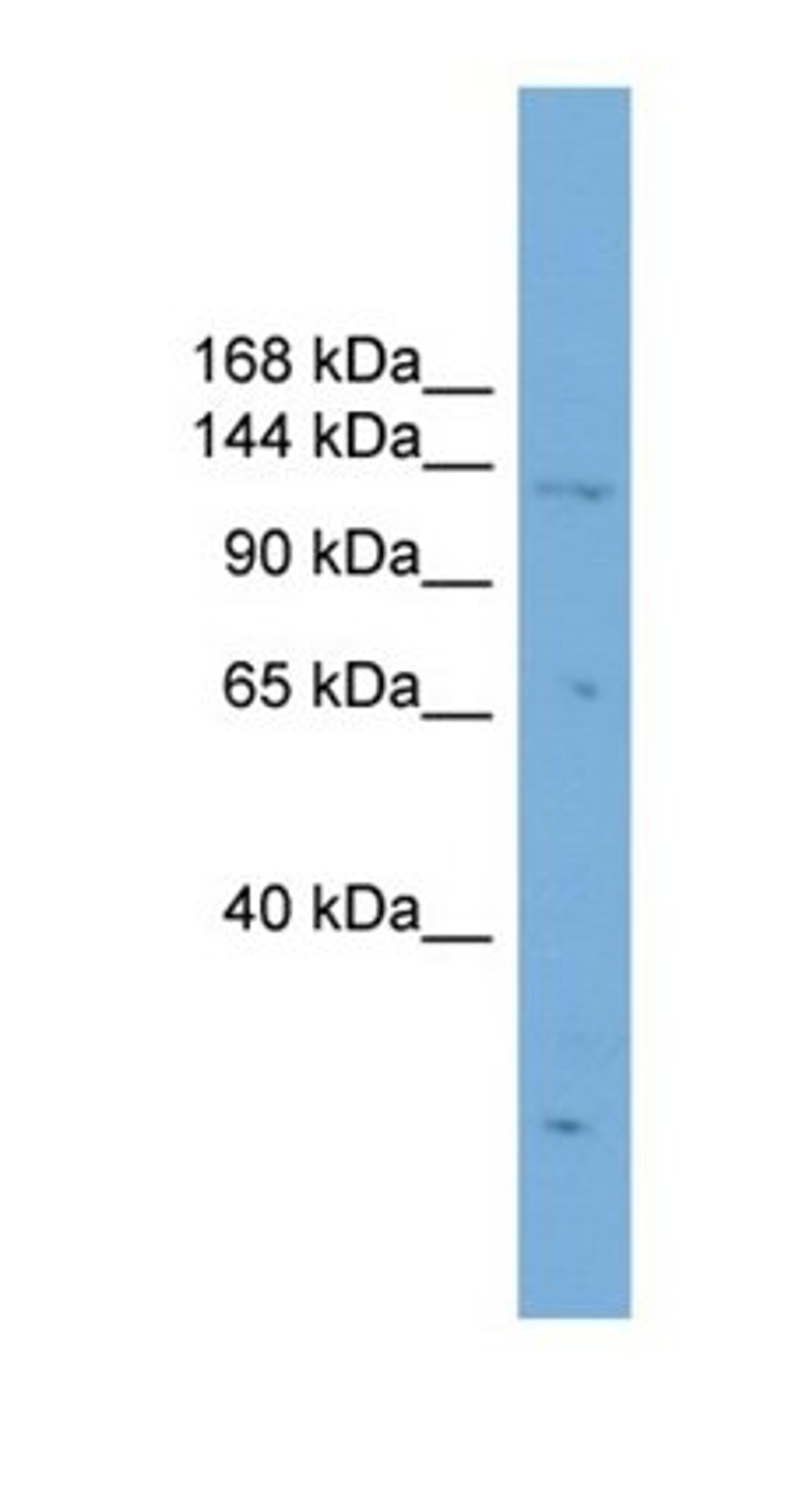 Western blot analysis of HepG2 cell lysate tissue using PRDM16 antibody