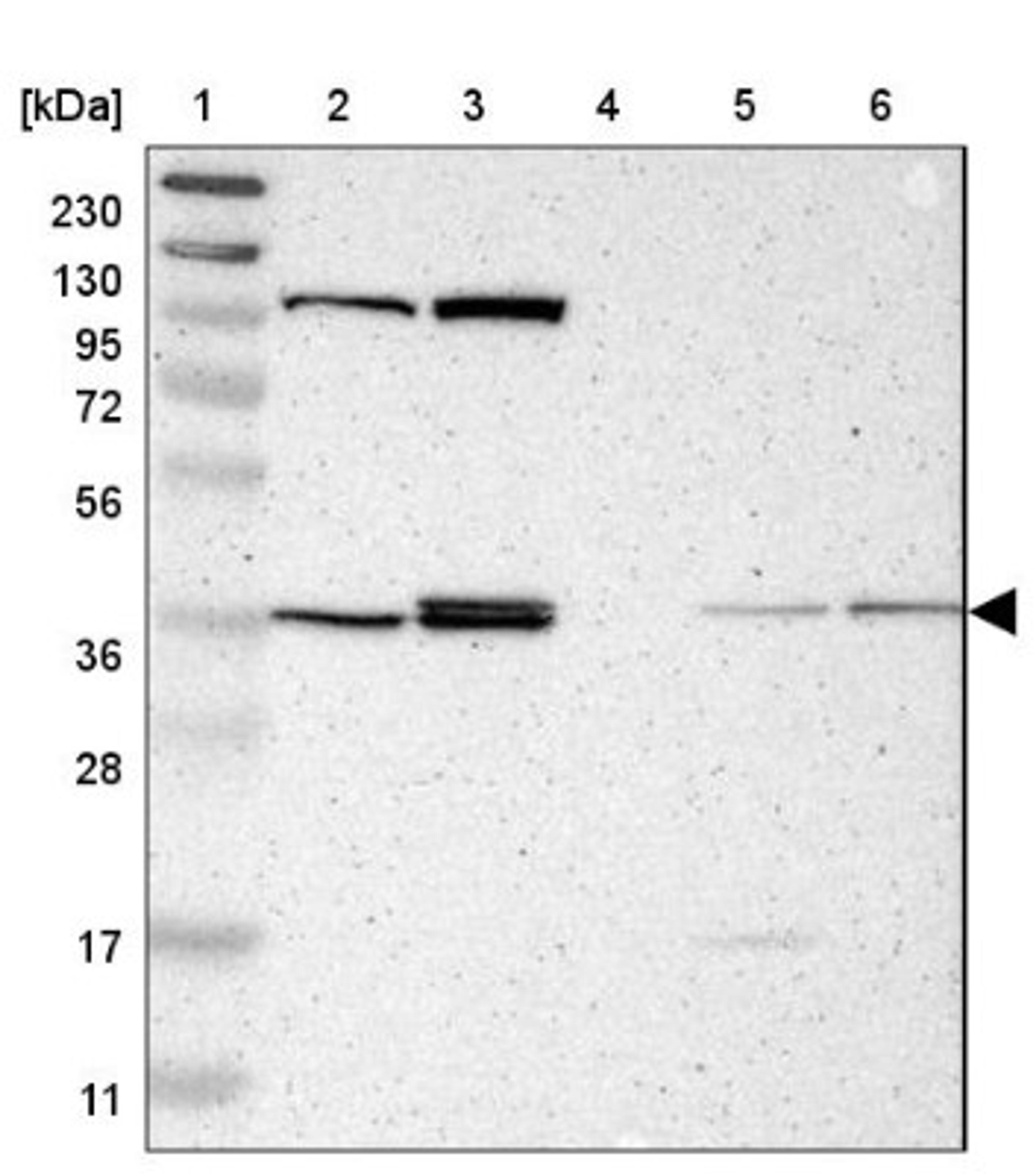 Western Blot: ALG5 Antibody [NBP1-88767] - Lane 1: Marker [kDa] 230, 130, 95, 72, 56, 36, 28, 17, 11<br/>Lane 2: Human cell line RT-4<br/>Lane 3: Human cell line U-251MG sp<br/>Lane 4: Human plasma (IgG/HSA depleted)<br/>Lane 5: Human liver tissue<br/>Lane 6: Human tonsil tissue